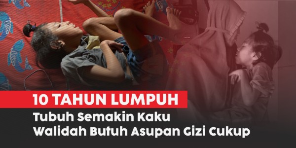Lumpuh Sejak Usia 2 Bulan, Walidah Butuh Asupan Gizi Cukup