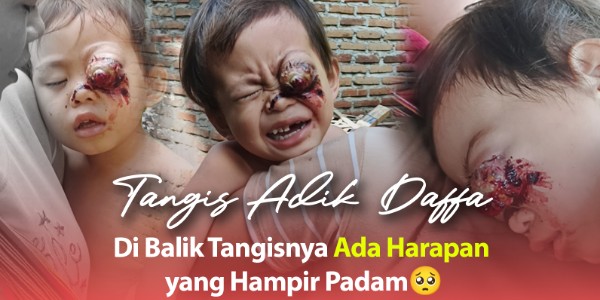 Bantu Daffa Melawan Luka di Matanya