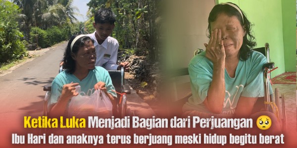 Bantu Bu Hari Berobat Dari Penyakit Kulit Kronis Berbahaya